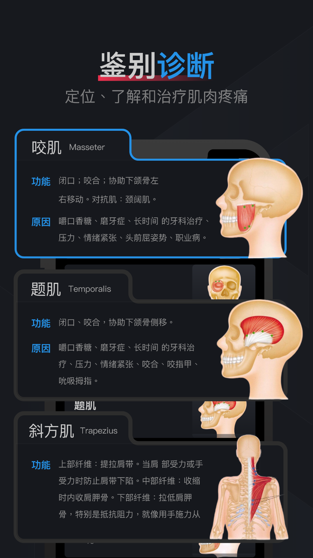 肌肉激痛点图谱第2张手机截图