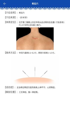 蒙医穴位标准化信息系统软件封面